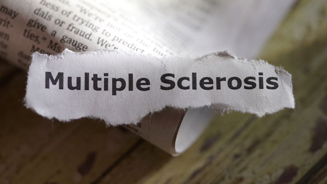 transcranial magnetic stimulation ms