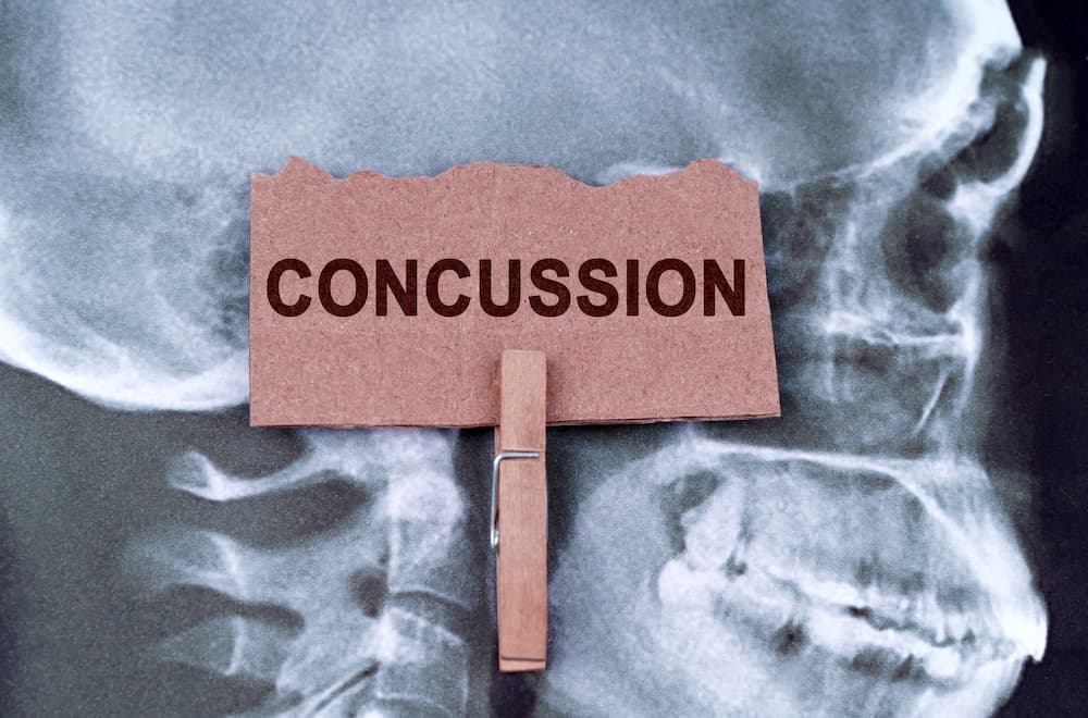 Medical image used for information about how long to recover from a concussion, featuring an X-ray and the injury keyword.